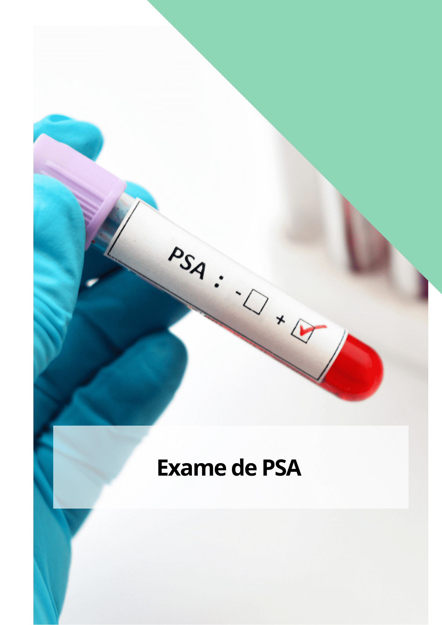 Exame de PSA - Laboratório Niterói