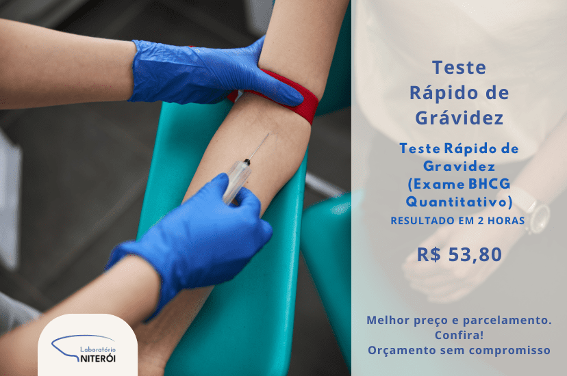 Lab niterói niteroi - PopLab - Banner site